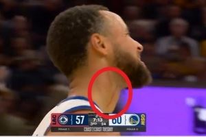 库里:血痕是之前打湖人那场留下的 看起来要比实际情况严重